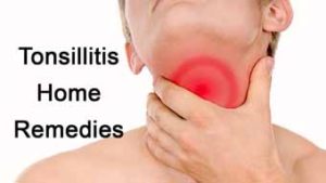 Home remedies for tonsils